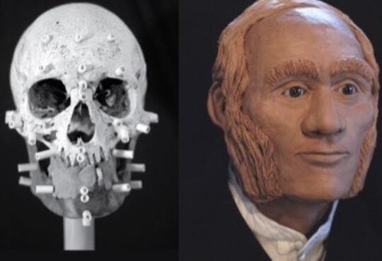 human skull and facial reconstruction