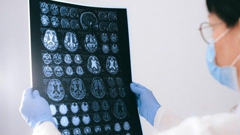 doctor observing brain images