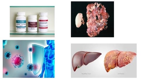 Four images illustrating sex differences in physiology: Over The Counter Pain Relievers, End-stage human autosomal dominant polycystic kidney (right) compared with a healthy kidney, A shield to block virus from human, and A healthy liver vs a liver with disease
