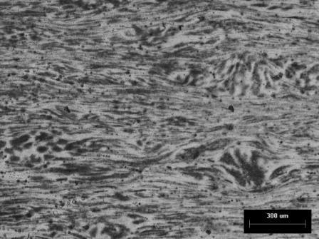 The microstructure of the magnesium alloy