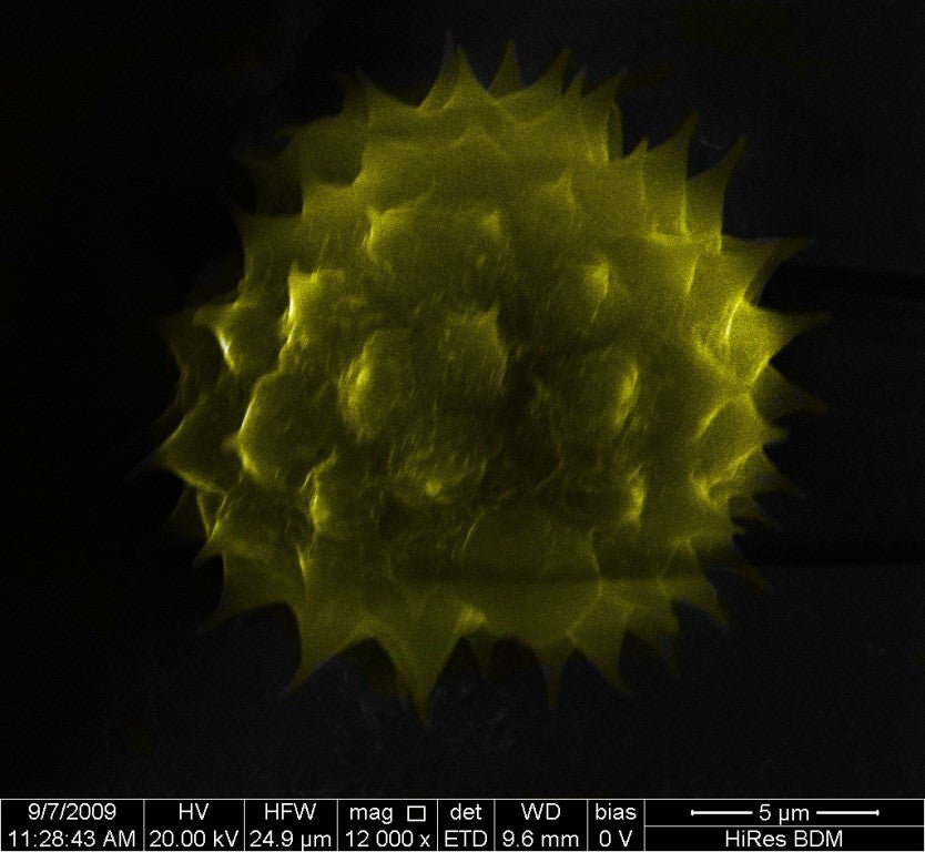 Pollen grain at 12000X magnification.