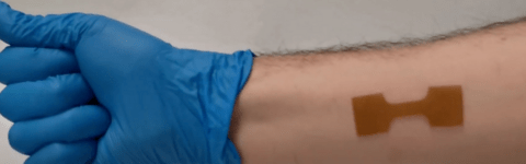 Arm with wound dressing applied