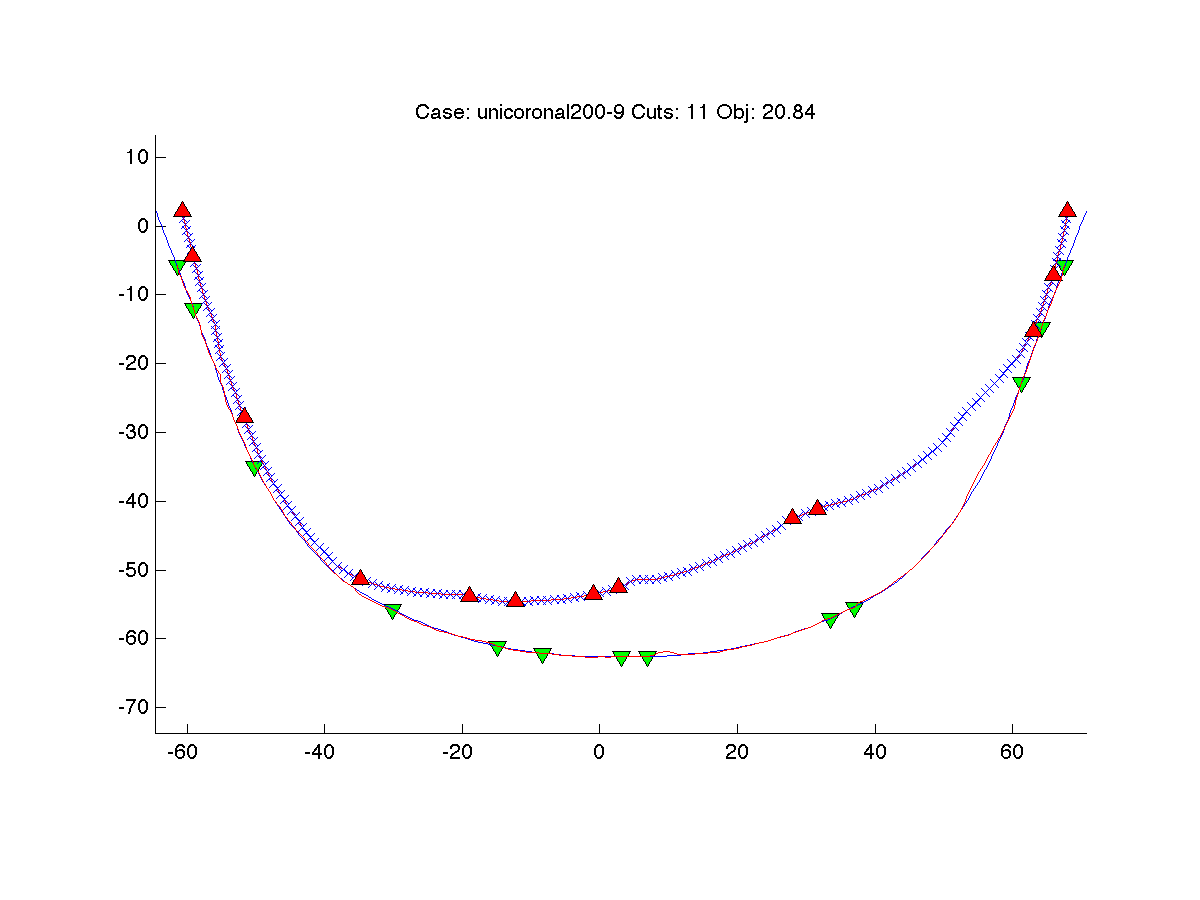 Mathematical algorithms to minimize the volume-difference between the surgically modified skull, and an ideal skull