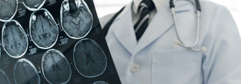Doctor viewing brain scan