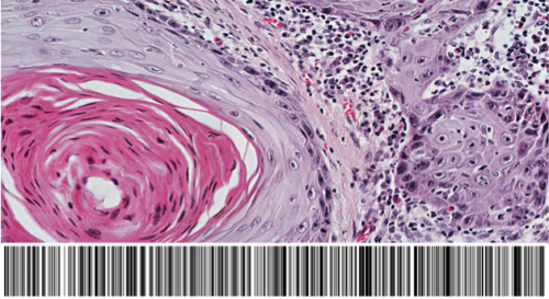A medical image tagged with a barcode.