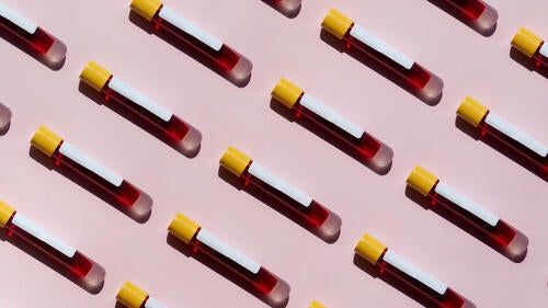 Rows of vials of blood samples.