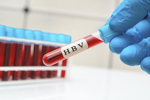 A gloved hand holds a vial of blood marked &quot;HBV.&quot;