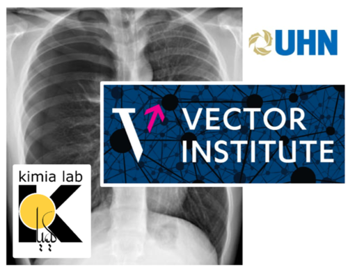 Vector Institute image showing an x-ray of a human torso.