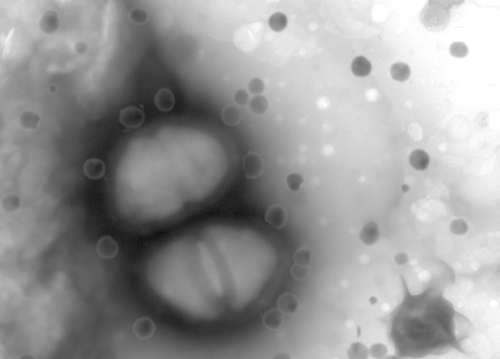 A closeup of bacteria.