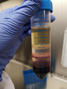 A blood sample separated into its components in a tube.