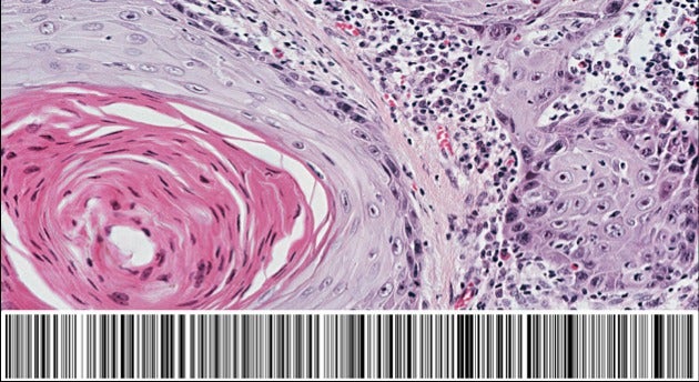 A medical image tagged with a barcode.