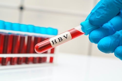 A gloved hand holds a vial of blood marked &quot;HBV.&quot;