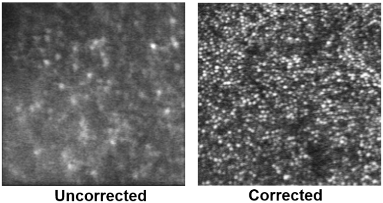 On the left is an image from a video of the cone photoreceptor layer in a living human retina before correction of the optics of the eye with a deformable mirror. Some blurred cone photoreceptors are visible. On the right is an image of the same region of the cone photoreceptors (bright circular structures) after correction of the wavefront to a spherical shape using an actively deforming mirror. Individual cone photoreceptors are resolved with high contrast. The black curve running from the bottom middle to the top right of the image is the shadow of a small blood vessel.
