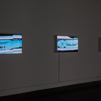 Three light boxes depicting distorted medical imagery.