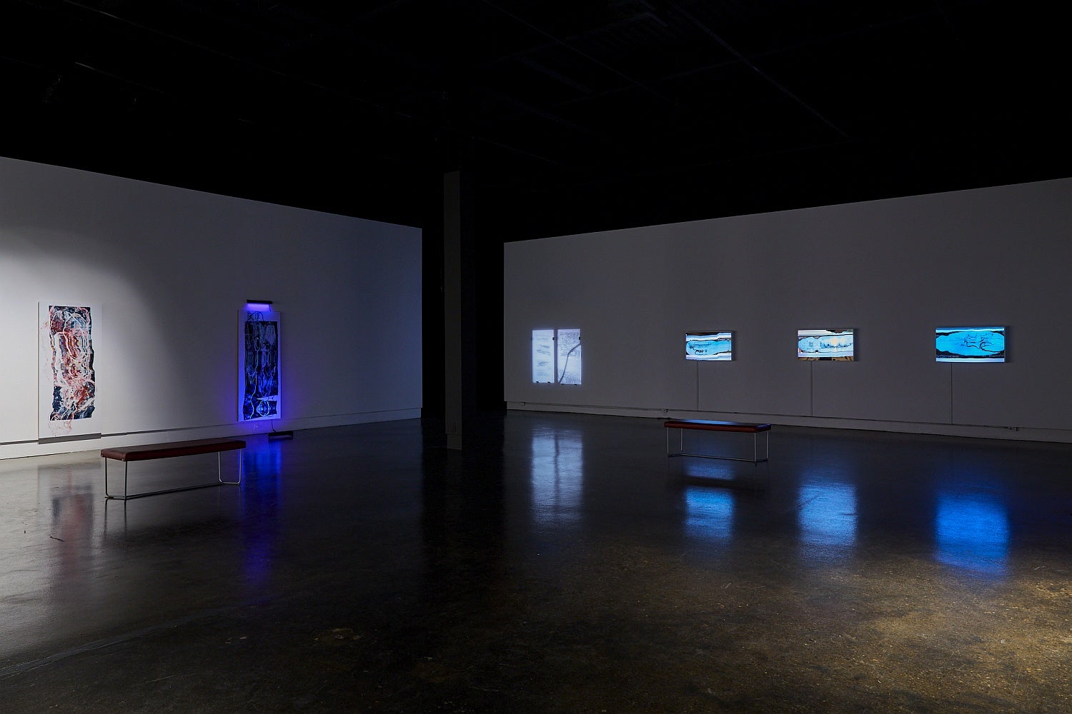 Art gallery installation of light boxes and large scale prints, some lit by ultraviolet light, of distorted medical scans.