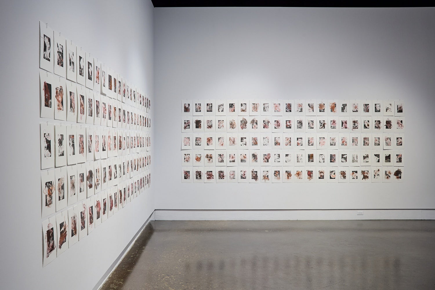 Multiple prints depicting medical waste that are hung in two grids with 100 prints each.