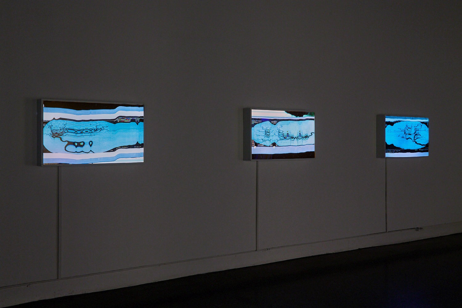 Three light boxes depicting distorted medical imagery.