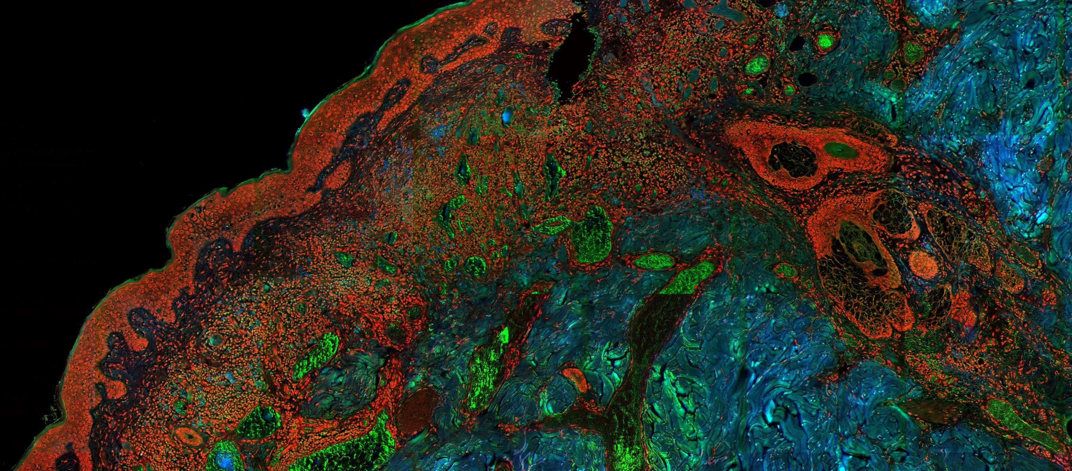 Optical medical image