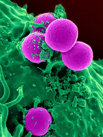 Scanning electron micrograph of a human neutrophil ingesting MRSA 