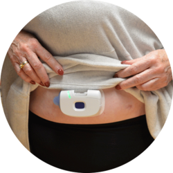 At-home wearable placed on abdomen.
