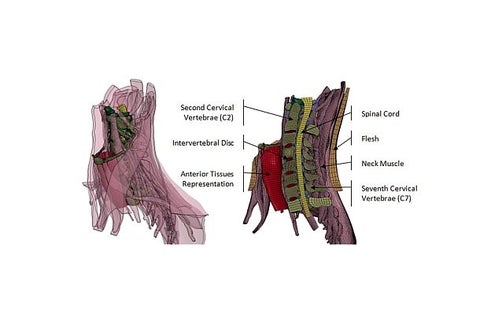 diagram of a human neck with labels