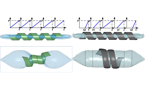 BALLOON EXPANSION OF A HELICAL POLYMERIC CORONARY ARTERY STENT