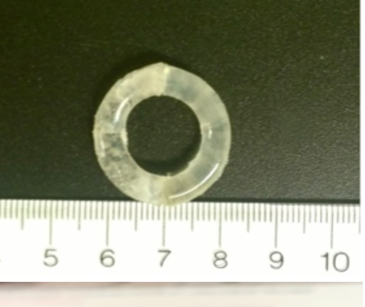 Smart Segmented ring device