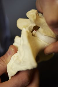 Model of spine showing herniation bulge.