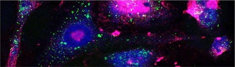 Image depicts drug-tolerant cells (Goldman et al.)