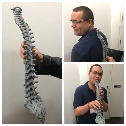 Fun with a 3D printed spine