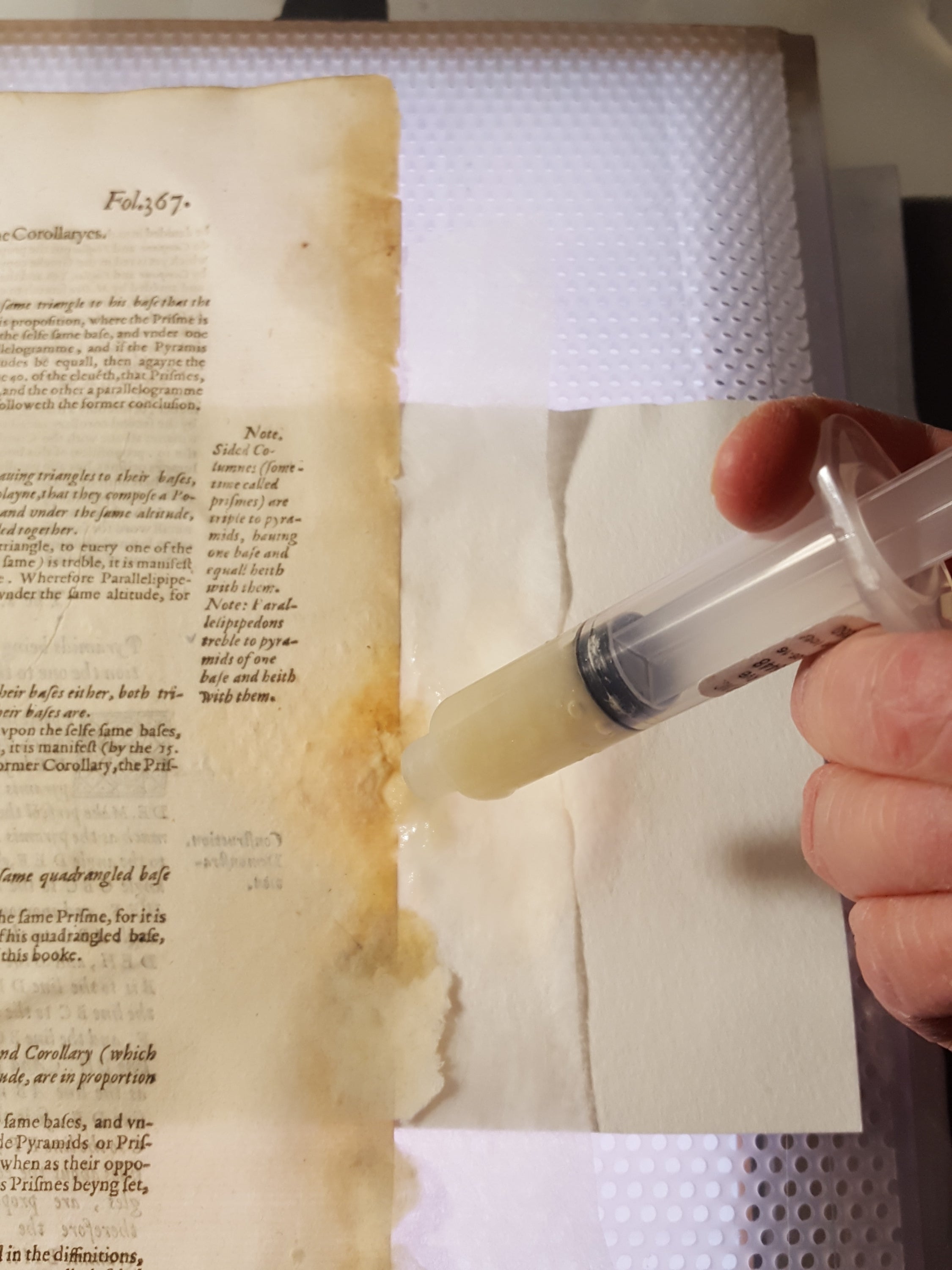 Pulp being applied with syringe