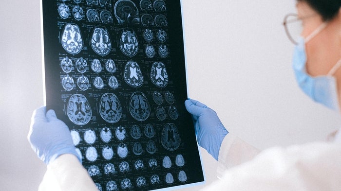 A doctor looks at brain scans