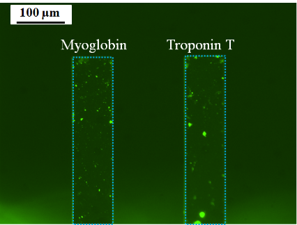 100 micrometer-scale view of Myoglobin and Troponin T.