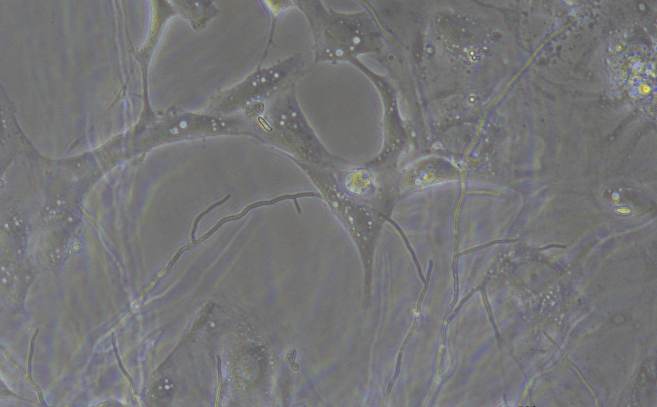 P. destructans hyphae poking through bat cells from a bat cell line.