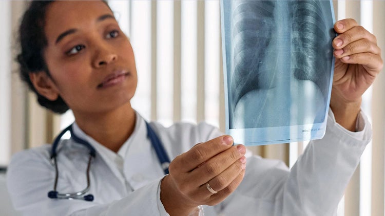 woman holding x ray image
