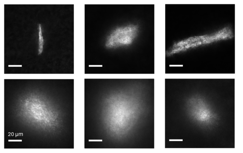 Glowing protein deposits on retinal samples