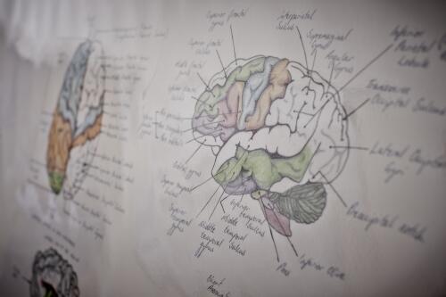 A diagram of the human brain.