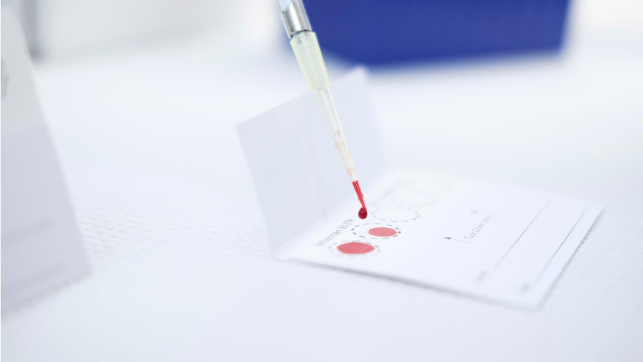 Blood test on sheet of paper