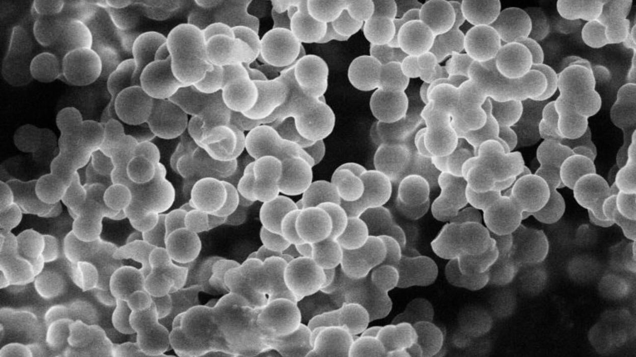 A close-up view of a carbon powder created by Waterloo Engineering researchers.