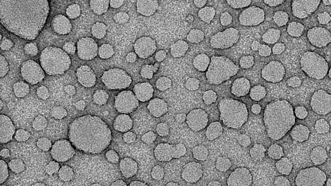 microscope image of nanoparticles