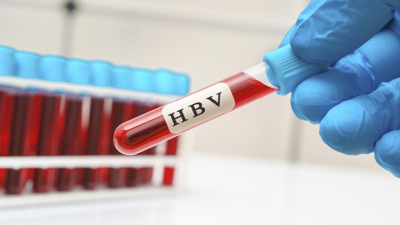 Hepatitis B virus blood test