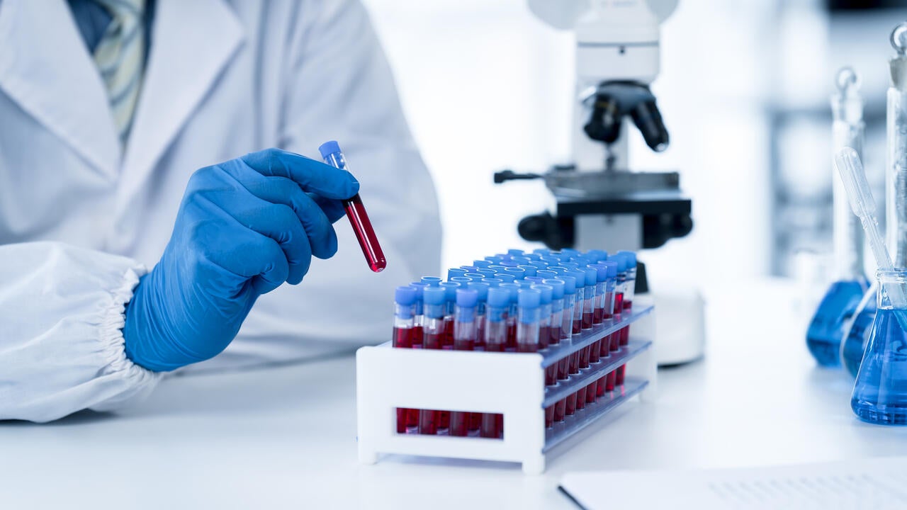 Doctor taking blood sample tube from rack with machines for analysis in the background. (Getty Images/Perawit Boonchu)