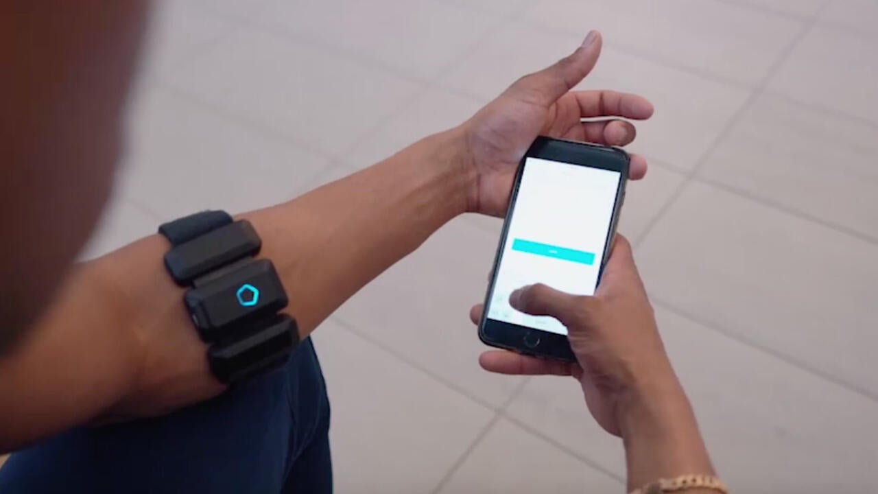 Wearable device attached to an arm