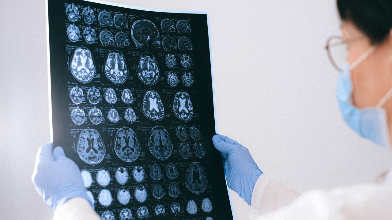 Doctor examines images of a brain