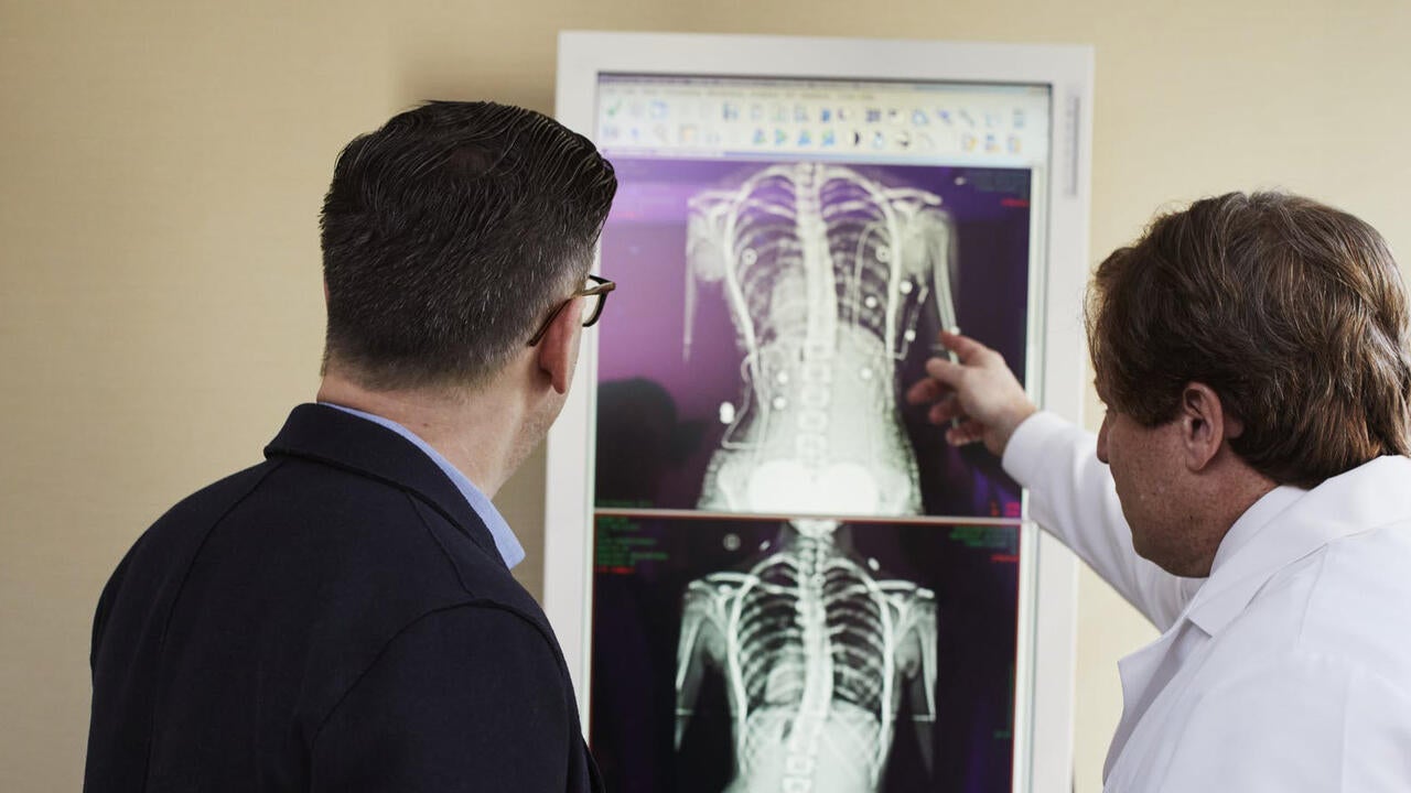 Doctor pointing to x-ray results to man wearing black suit