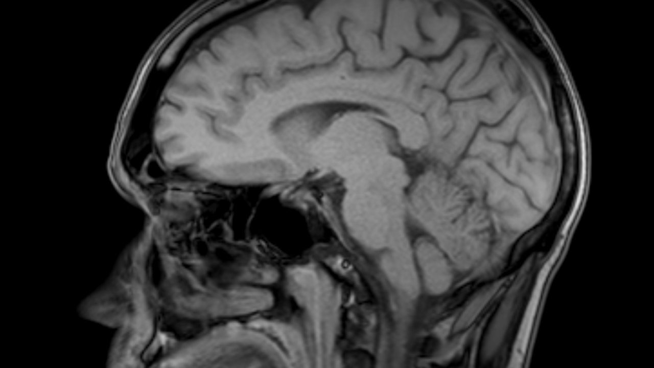 Brite Brain – Physician Designed™