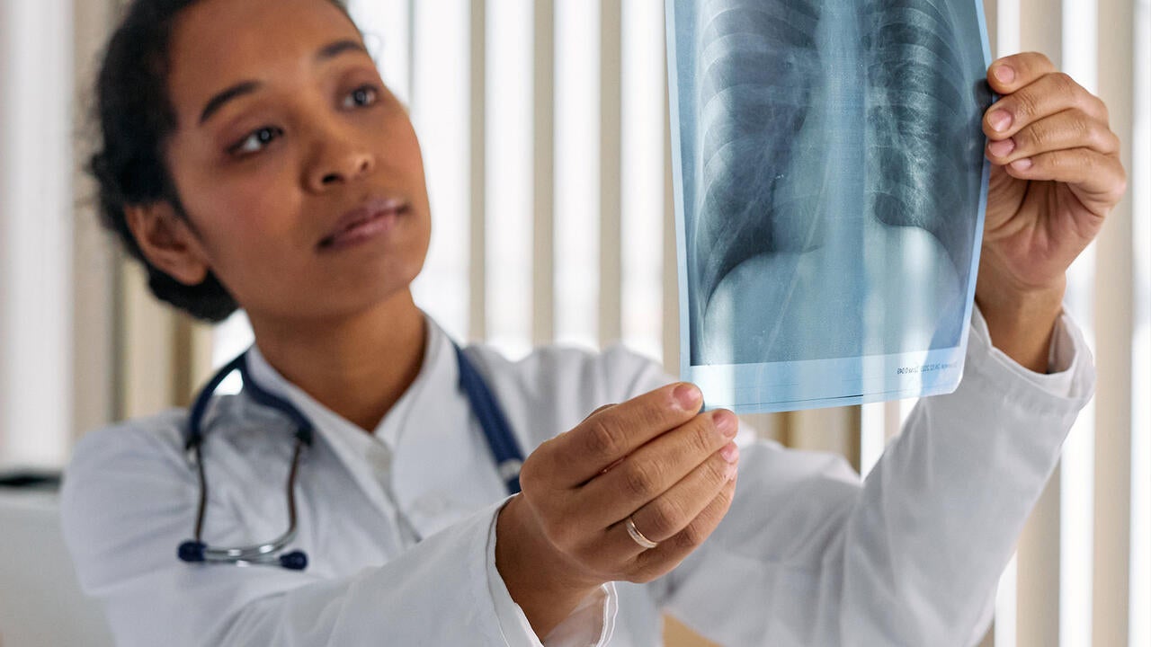 medical professional looking at x ray