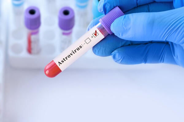 Doctor holding a test blood sample tube with Astrovirus PCR test on the background of medical test tubes with analyzes.