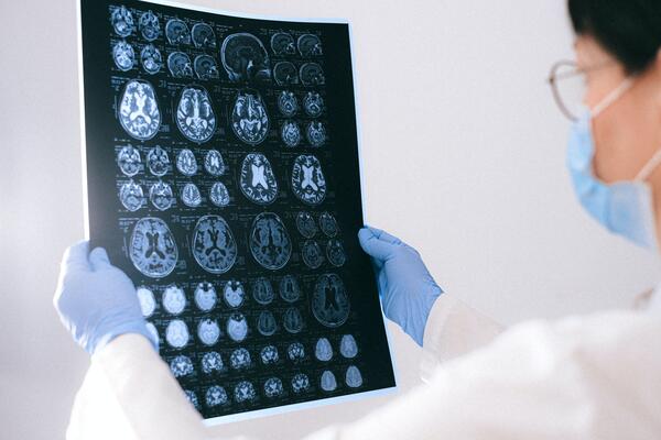 Doctor examines images of a brain