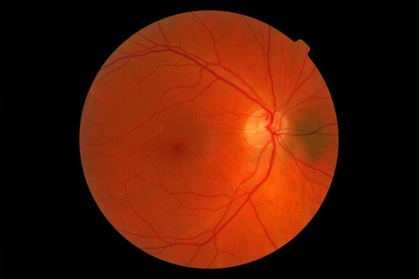 Image of retina eye scan